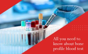 About Bone Profile Blood Test – All You Need To Know 2023